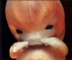 Gesicht eines Embryos in der 07. Schwangerschaftswoche