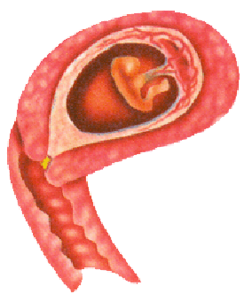 Embryo in der 08.Schwangerschaftswoche
