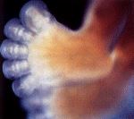Füße eines Embryos in der 08. Schwangerschaftswoche