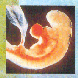 Embryo in der 04. Schwangerschaftswoche