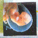 Embryo in der 06. Schwangerschaftswoche